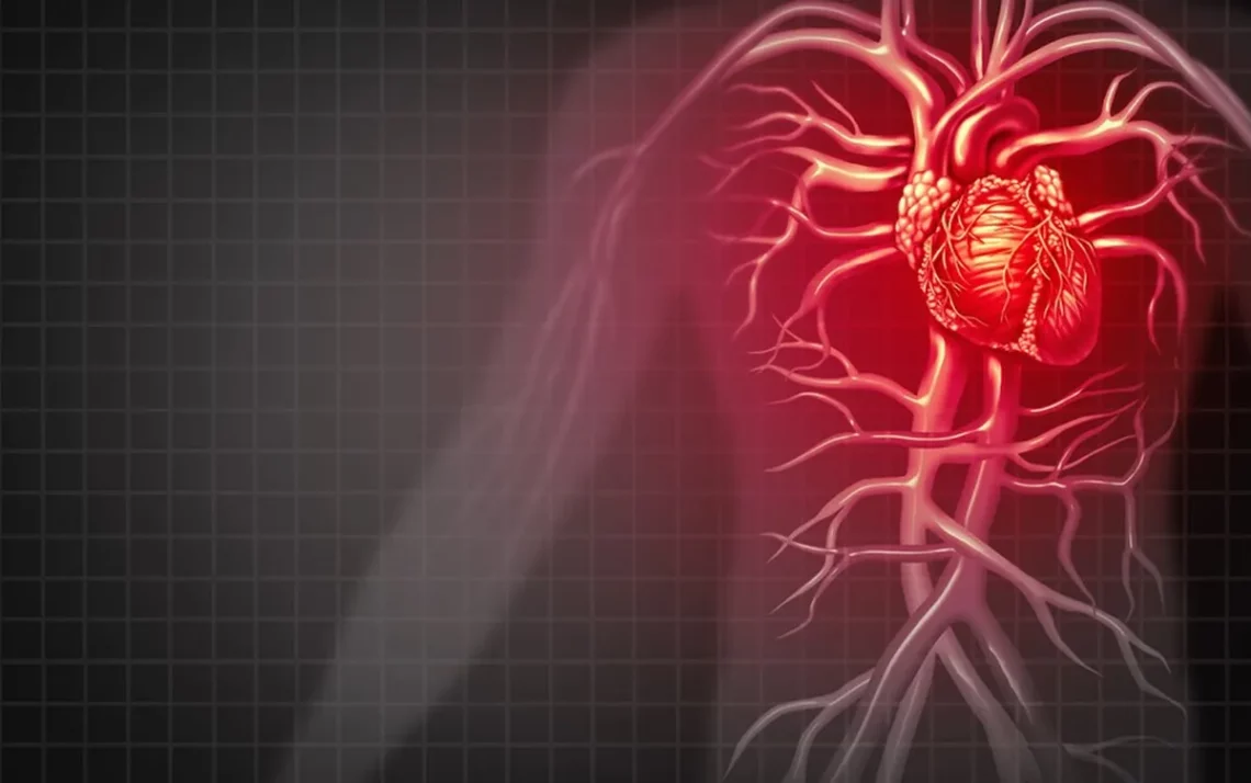 inflamação do músculo cardíaco, inflamação das fibras musculares do músculo cardíaco