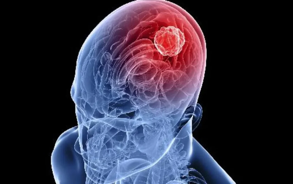 vacina contra glioblastoma