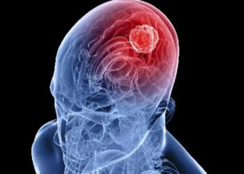 vacina contra glioblastoma